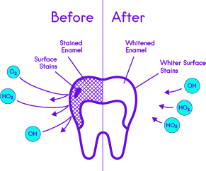 Whitening Strips Action on Teeth